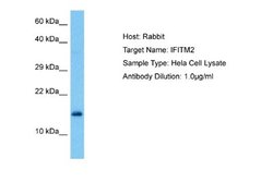 IFITM2 Rabbit anti-Human, Polyclonal, Novus Biologicals 0.1 mL | Buy Online | Novus Biologicals | Fisher Scientific